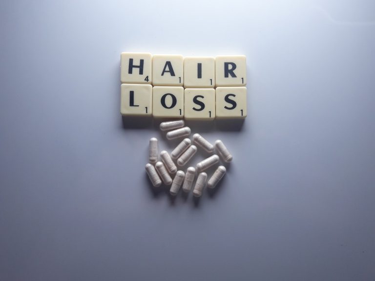 https://thatsassymom.co.za/wp-content/uploads/2023/05/hair-loss-g3c9efe92c_1280.jpg